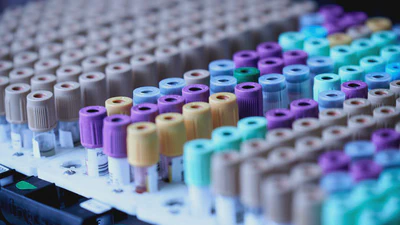Research Assistant - Epigenomics featured image